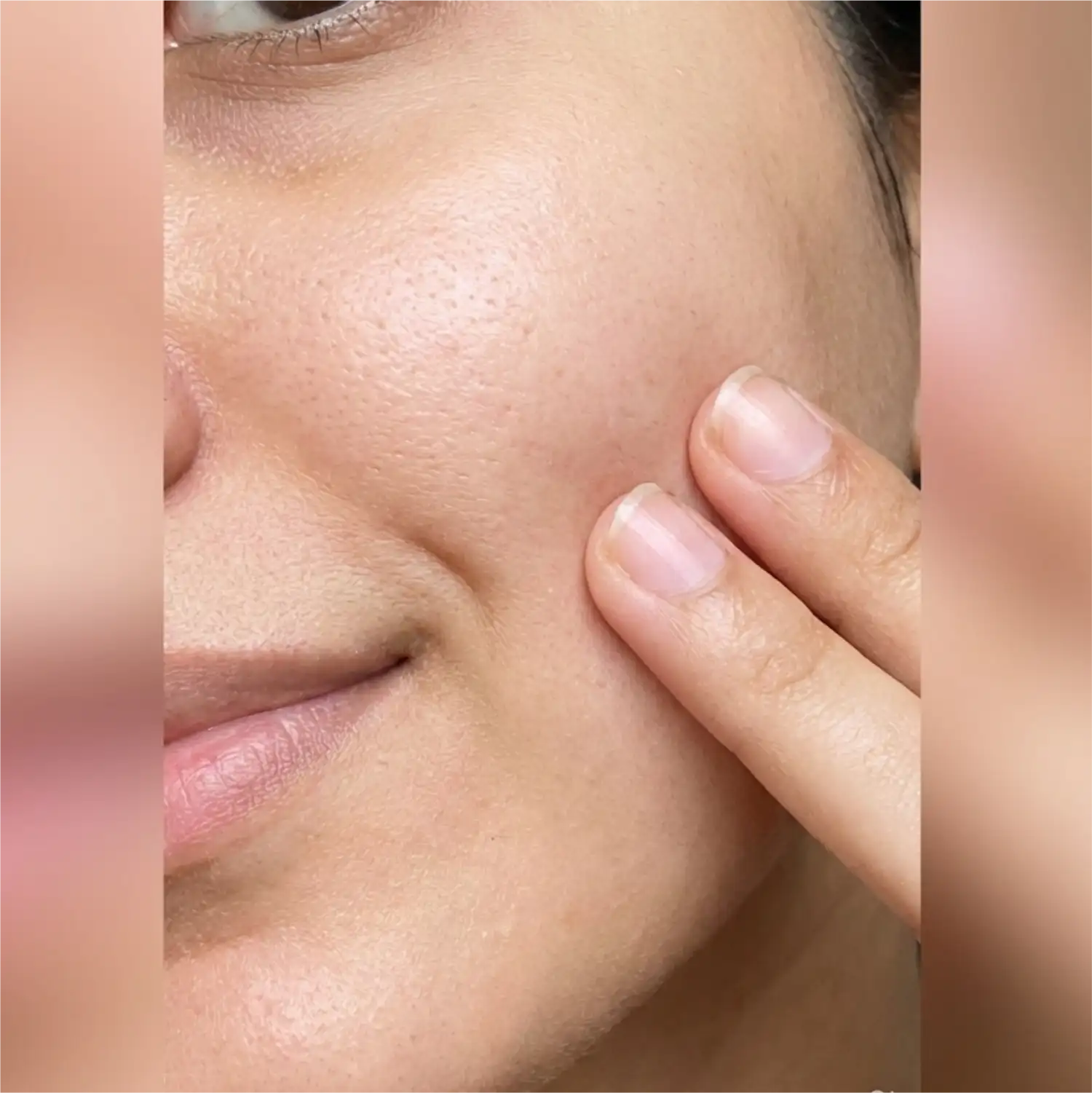 Pores looking refined